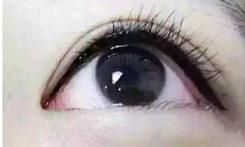 ���۾���ʲô��̎