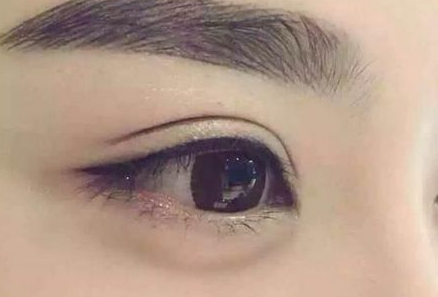 �p��Ƥ����Ҫע��ʲô