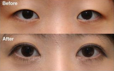 ���p��Ƥ����Ҫע��ʲô