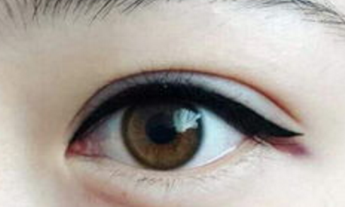 �p��Ƥ���εă�ȱ�c