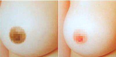 ��Ҋ���镞Ư�׷���