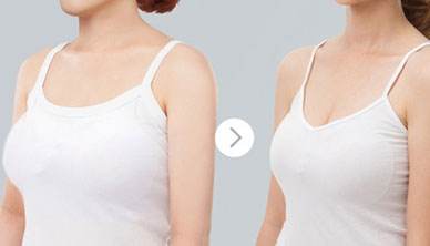 �ز��sС�Æ�