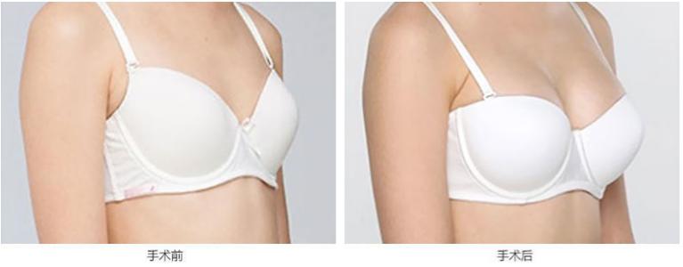 ����sСǰ�󌦱ȈD