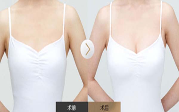 ����sС�g��Щ�˲�����