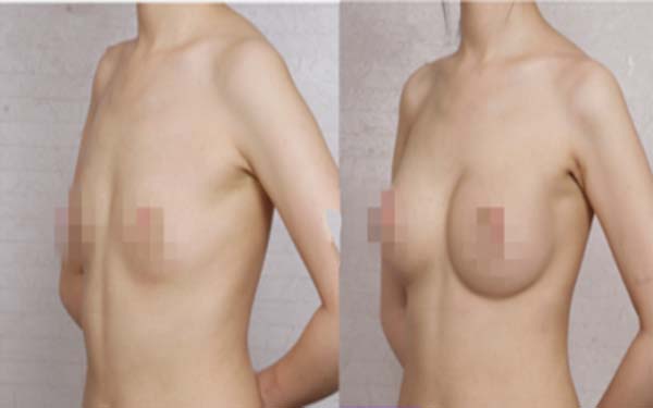  �P��Ӱ푾���sС���gЧ��������