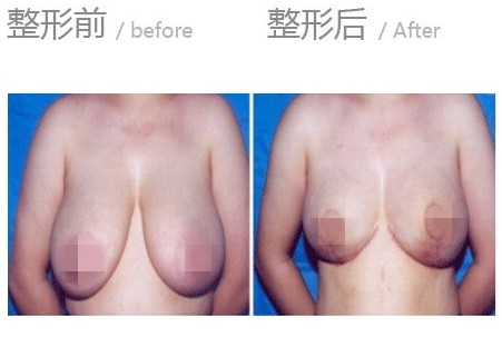 ����sС�g���gǰ�ʂ���g���o��