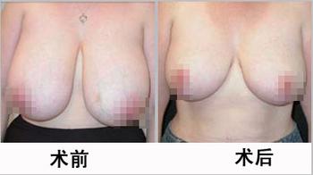 ����sС�g�İ�ȫ�c��Щ�������P