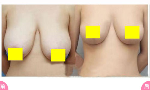 ����sС�g�ķ�������Щ