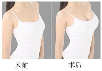 ���w֬�����ڰ���