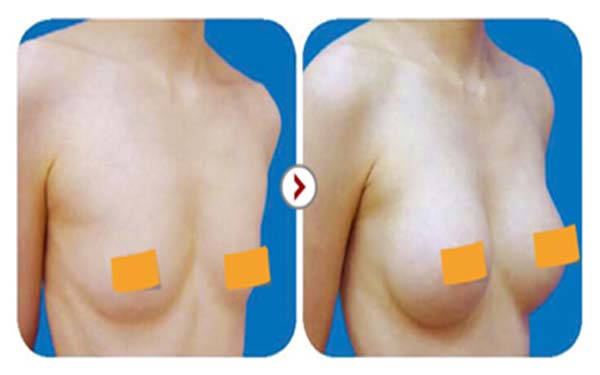 ���w¡�غ���������Ӳ�Ć�