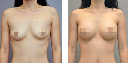 ע��¡�����g(sh��)���M��