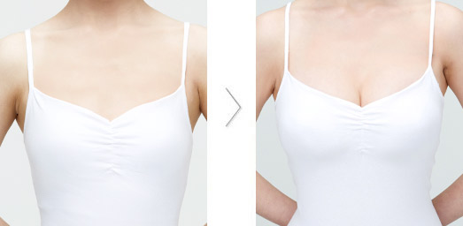 ȡ¡�ض����X