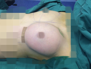 ��֬���S�ص��挍(sh��)��ӛ