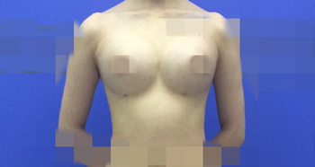 ��֬���S�ص��挍(sh��)��ӛ