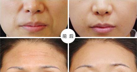 �沿����֬�۲���