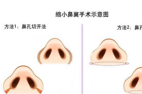 �����sС���g(sh��)�^�̈D