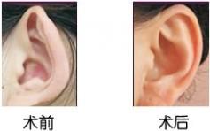 �����������g(sh��)������ʲô