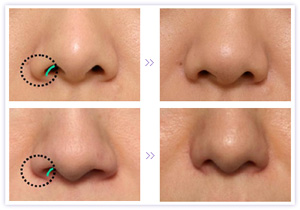 �����ʴ�������Σ�U��