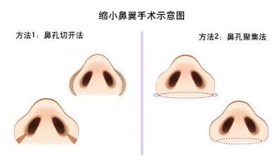 ���������g(sh��)��ע�����(xi��ng)