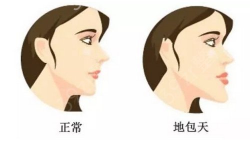 深圳植發(fā)醫(yī)院哪家好