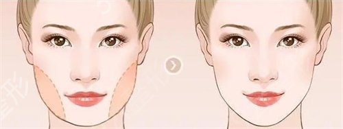�Ϸ��t(y��)�ƴ�W(xu��)�Ϸ��t(y��)Ժ׌�Ҕ[Ó�˴���Ę�ɞ�СVĘ��
