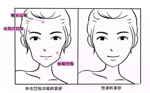 �˴�̎�l���沿��Ƥ�����ð�