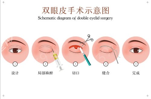 2022深圳去眼袋醫(yī)療美容機構(gòu)排名表來了