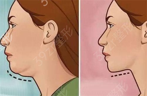 �Ϻ��נ�������A��ĥ���Ă�(g��)��