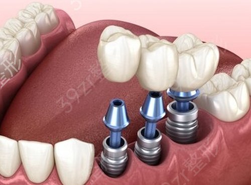 �o�a�Nֲ���ڱ��õ�3���t(y��)Ժ���ι���