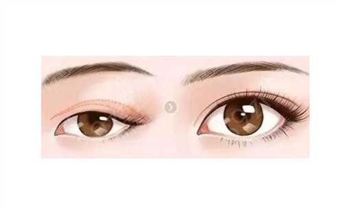 ���(y��ng)�ڱ����^�õ������t(y��)Ժ����Ԕ��l(f��)��