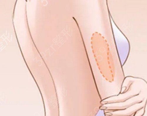 ��Ժע���ݼ�Ҫ��ʲô��