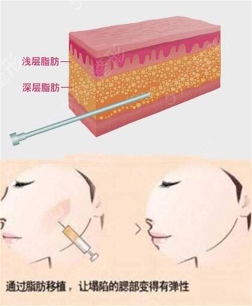 ���������κ͖|�����C�沿֬������Ă���