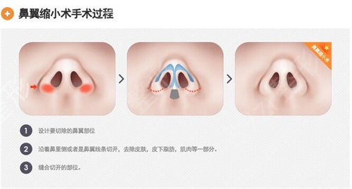 長(zhǎng)沙隆鼻比較出名的醫(yī)院前三名單