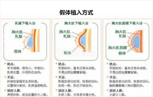������(d��ng)����������Ҏ(gu��)�t(y��)Ժ?ji��n)? /></p> <p>  <strong>  ���T(m��n)�(xi��ng)Ŀ��</strong></p> <p>    ���z¡�أ�Ŀǰ��Ů�Ե�*�������������������g(sh��)�󲻕�(hu��)���F(xi��n)���l(f��)�Y��Ҳ����(hu��)Ӱ�δ��(l��i)�����������ĸ��ι�B(y��ng)����׌����(g��)�˸���������</p> <p>    �p��Ƥȫ��:�ϲ����g(sh��)����(du��)��һЩƤ�w��(y��n)���ɳڡ��o(w��)���Ի򰙼y���ˁ�(l��i)�f(shu��)���������ǂ�(g��)���e(cu��)���x�񣬻֏�(f��)��������������p��Ƥ�Π</p> <p>    �p�°���֬�p�ʣ�һ���(l��i)�f(shu��)����(d��ng)�p�°͕r(sh��)������(g��)Ę����(hu��)��һЩ���f(xi��)�{(di��o)���҂��������°�̎�ҵ����m��λ�ã���ؓ(f��)��ȥ��Ƥ��֬�����Ķ��_(d��)���°͡����ĺ����ݵ�Ŀ�ġ��@�N�����](m��i)�к��E���������������p�°ͣ�����֬���S������(l��i)�ĸ��Nӷ�[��</p>  <br /></div>

						<map ifdisplay lang=