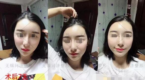 �o(w��)�aͬ��(j��)����֬��ȫĘ������g(sh��)��(g��)���挍(sh��)ӛ�