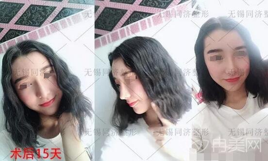 �o(w��)�aͬ��(j��)����֬��ȫĘ������g(sh��)��(g��)���挍(sh��)ӛ�