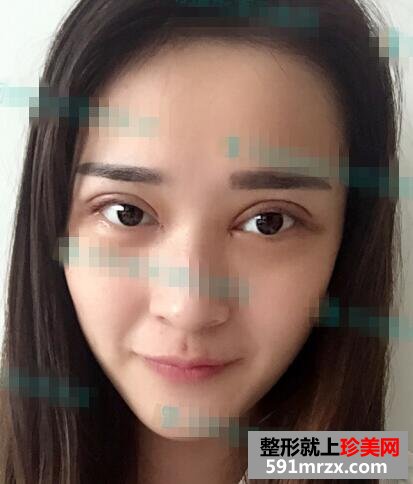 С�����p��Ƥ�g���o��֪�R����