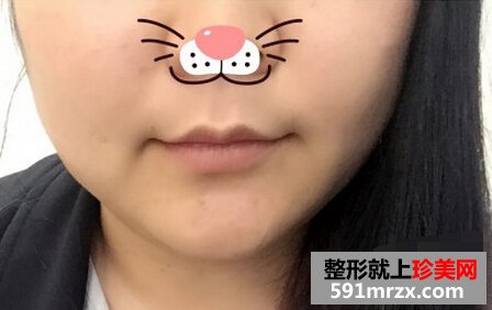 ���δ���Ęᘣ�Ч��߀�ǺܝM��ģ�