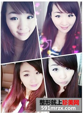 ���p��Ƥ��û֏�(f��)