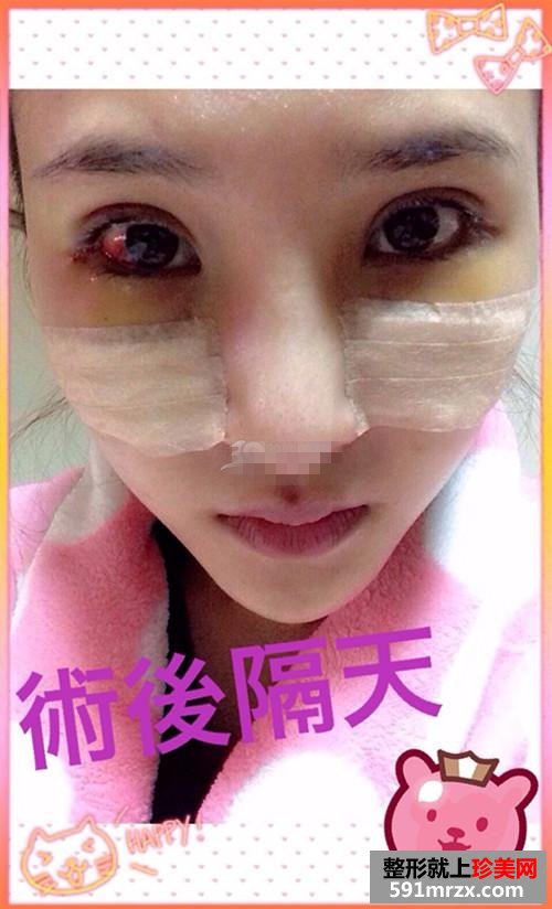 ��(n��i)�p���p��Ƥ���g(sh��) �ҵ�����׃����