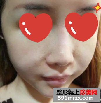 ������ƤЧ��̫�@�G �ό�(du��)�ȈD�o���Â�����