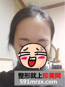 �Nֲ�^�l(f��)ǰ��Ч��չʾ �Nֲ�^�l(f��)��������