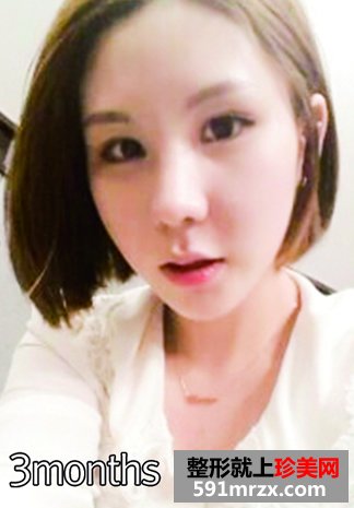 �ű������p��Ƥ���g(sh��)�֏�(f��)�^�̷���