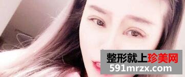 ���p��Ƥ���_�۽����g(sh��)�֏�(f��)�D