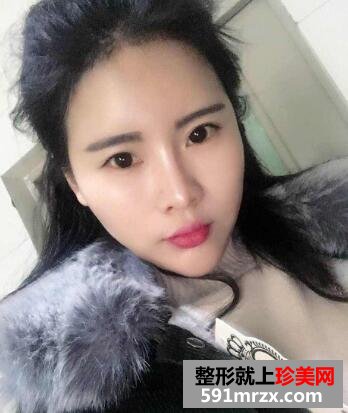 ���w֬���沿���֏�(f��)�D