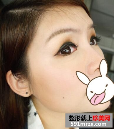 ���^������ȥע���ⶾ����Ę+ȥ̧�^�y