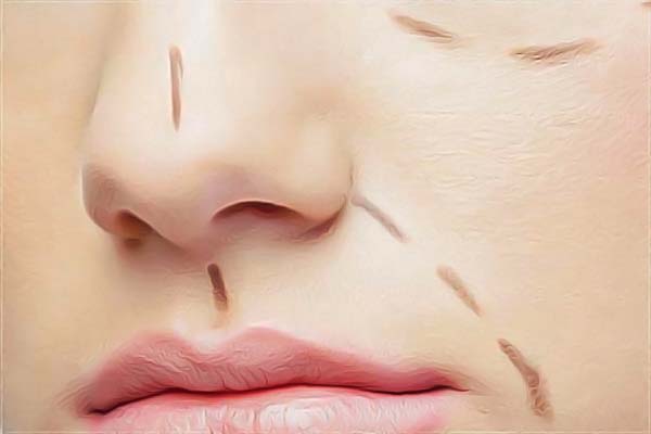 �K�����X�C���t(y��)Ժ������ι���