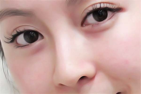 阜外醫(yī)院整形外科怎么樣 阜外醫(yī)院整形外科怎么樣